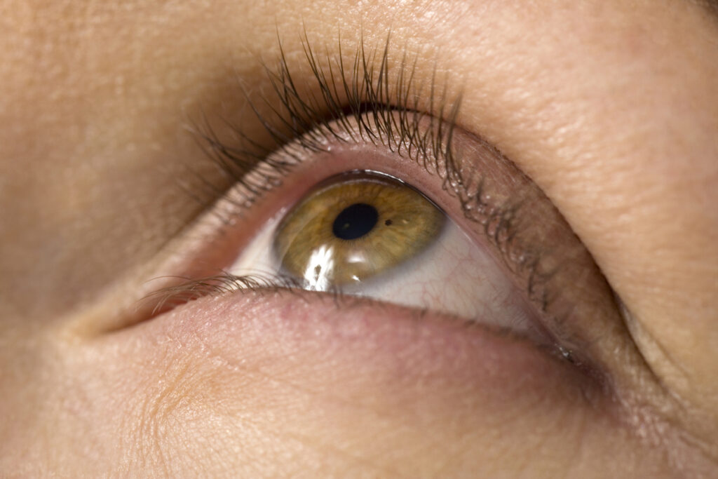 5 oorzaken van jeukende oogleden