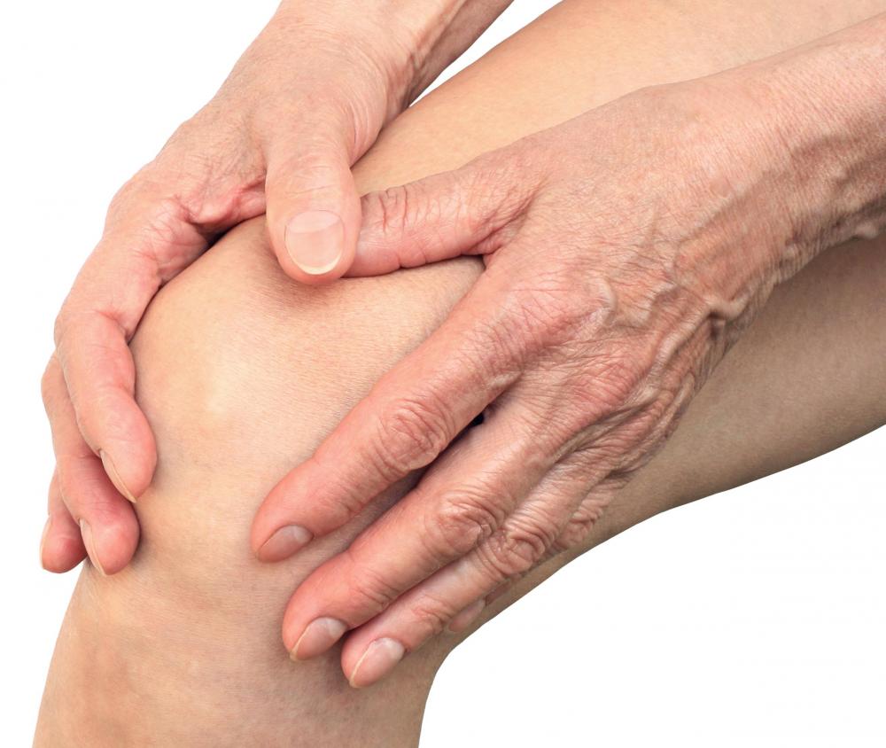 Reumatoïde artritis (Ontstekingsreuma): Symptomen & Behandeling